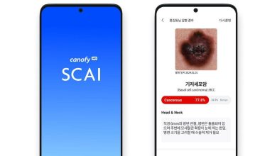 Coreia do Sul aprova primeira IA local de detecção de câncer de pele