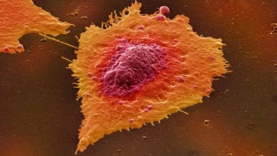 Células de câncer de cólon humano - 'Células de câncer de cólon humano', Annie Cavanag
